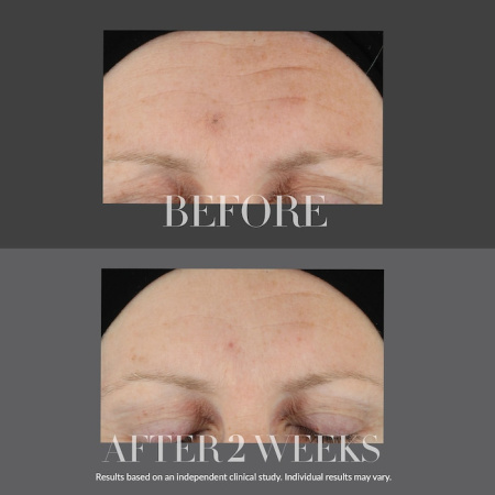 KATE SOMERVILLE KateCeuticals® Firming Serum with Hyaluronic Acid купить в Beauty Storage. Быстрая доставка по России и СНГ.