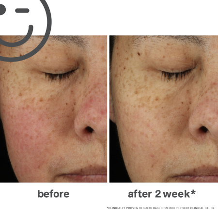 KATE SOMERVILLE KateCeuticals® Total Repair Cream купить в Beauty Storage. Быстрая доставка по России и СНГ.