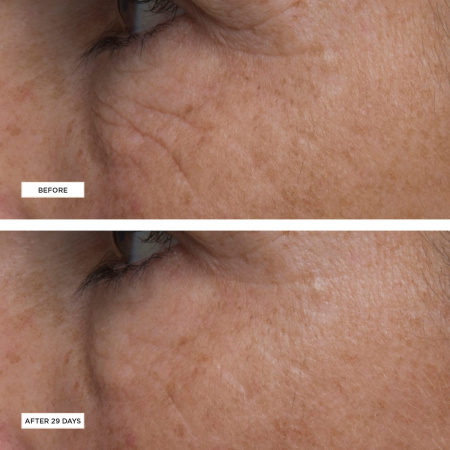 PERRICONE MD Cold Plasma+ Eye