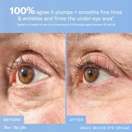 Купить THEN I MET YOU Snail Mucin Eye Cream на Beautystorage.ru. Быстрая доставка по России и СНГ.