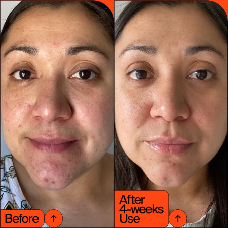 YOUTH TO THE PEOPLE 15% Vitamin C + Clean Caffeine Energy Serum купить в Beauty Storage. Быстрая доставка по России и СНГ.
