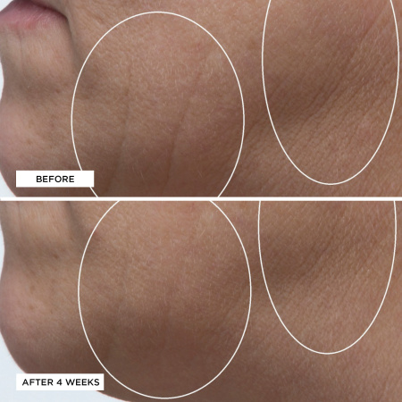 PERRICONE MD High Potency Classics: Hyaluronic Intensive Moisturizer