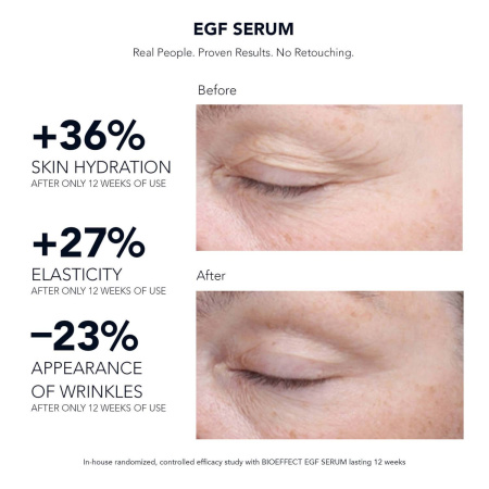 BIOEFFECT EGF Serum купить в Beauty Storage. Быстрая доставка по России и СНГ.
