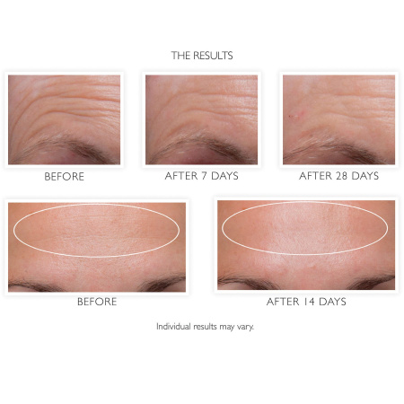 PETER THOMAS ROTH Hungarian Thermal Water Mineral-Rich Moisturizer