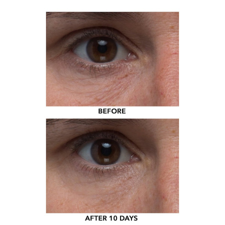 ALGENIST Triple Algae Eye Renewal Balm with Multi-Peptide Complex купить в Beauty Storage. Быстрая доставка по России и СНГ.