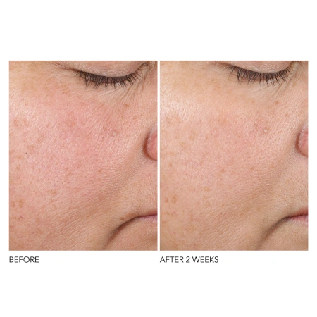 DR. DENNIS GROSS Advanced Retinol + Ferulic Texture Renewal Serum купить в Beauty Storage. Быстрая доставка по России и СНГ.
