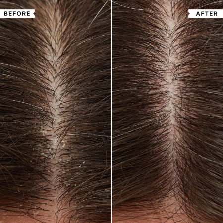 Купить PHILIP KINGSLEY Overnight Scalp Barrier Serum with Triple Balancing Action на Beautystorage.ru. Быстрая доставка по России и СНГ.