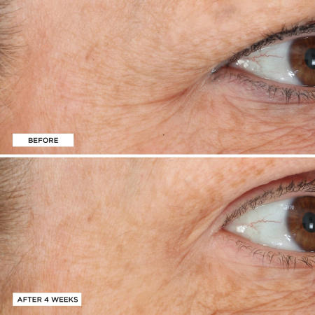 PERRICONE MD Essential Fx Acyl-Glutathione Eyelid Lift Serum