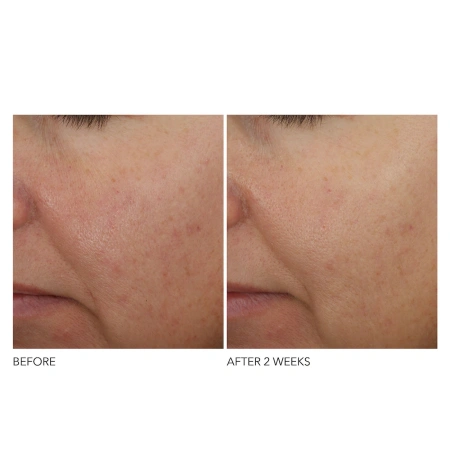 DR. DENNIS GROSS SKINCARE ADVANCED Retinol + Ferulic Overnight Wrinkle Treatment купить в Beauty Storage. Быстрая доставка по России и СНГ.
