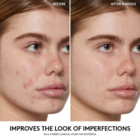 FENTY SKIN by Rihanna  Cherry Dub BHA Toner with Salicylic Acid + Aloe Juice купить в Beauty Storage. Быстрая доставка по России и СНГ.
