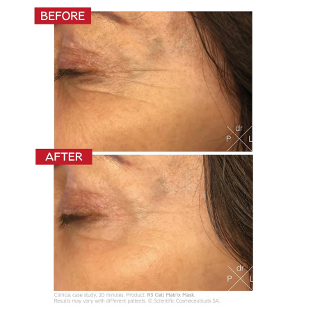 Dr. LEVY Switzerland R3 Cell Matrix Mask купить в Beauty Storage. Быстрая доставка по России и СНГ.