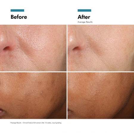 Купить SKINCEUTICALS Phloretin CF Antioxidant Serum for Normal, Combination, Discolouration-Prone Skin Types на Beautystorage.ru. Быстрая доставка по России и СНГ.