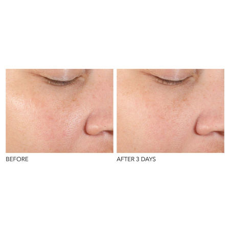 DR. DENNIS GROSS SKINCARE Alpha Beta® Pore Perfecting & Refining Serum