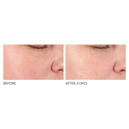 DR. DENNIS GROSS SKINCARE Alpha Beta® Pore Perfecting & Refining Serum