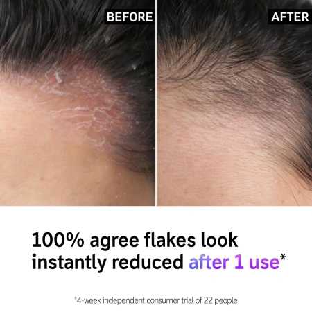 THE INKEY LIST Salicylic Acid Oily Scalp Treatment купить в Beauty Storage. Быстрая доставка по России и СНГ.