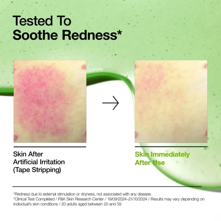 Купить ANUA Azelaic Acid 10 Hyaluron Redness Soothing Serum на Beautystorage.ru. Быстрая доставка по России и СНГ.